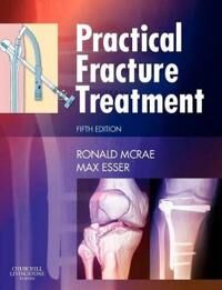 Practical Fracture Treatment Av Ronald (Formerly Consultant Orthopaedic Surgeon Southern General Hospital Glasgow Uk) Mcrae, Max (Orthopaedic Surgeon