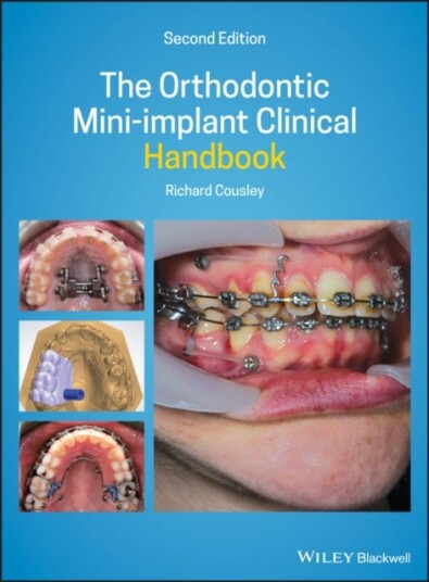 The Orthodontic Mini-Implant Clinical Handbook Av Richard (Consultant Orthodontist For The Peterborough & Stamford Hospitals Nhs Foundation Trust)