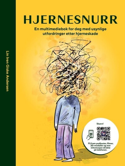 Hjernesnurr