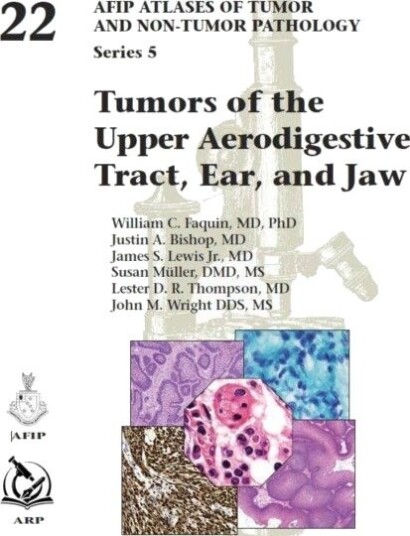 Tumors of the Upper Aerodigestive Tract, Ear, and Jaw