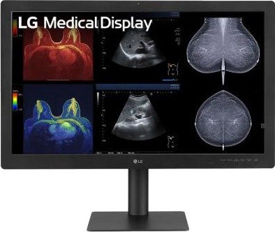 LG Diagnostisk Skjerm 31.5" 8MP 32HQ713D M LG Diagnostisk Skjerm 31.5" 8MP 32HQ713D M