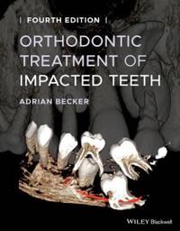Orthodontic Treatment Of Impacted Teeth Av Adrian (Department Of Orthodontics At The Hebrew University-Hadassah School Of Dental Medicine Jerusalem) B