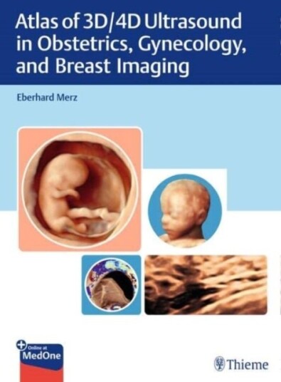 Atlas of 3D/4D Ultrasound in Obstetrics Gynecology and Breast Imaging
