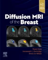 Diffusion Mri Of The Breast
