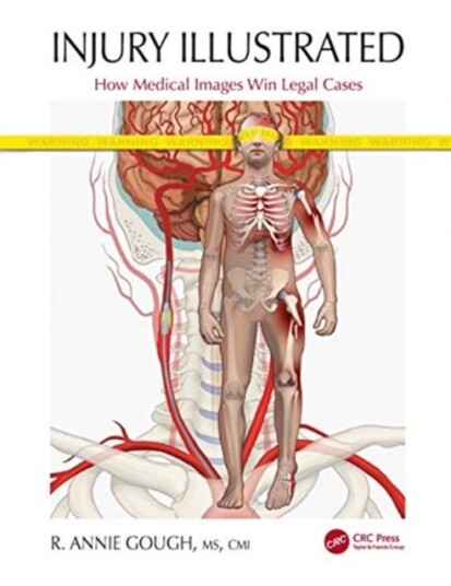 Injury Illustrated How Medical Images Win Legal Cases