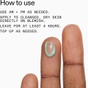 The Inkey List Succinic Acid Treatment 15ml