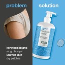 Salicylic Acid Keratosis Wash 500 ml