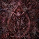 Vulvectomy  Aberrant Vaginal Gestation  CD