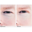 WONDERSTRIPES Cosmetics  The instant eye lift S