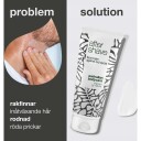 Australian Bodycare Aftershave Balm Mot Røde Nupper 100ml
