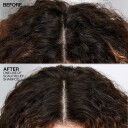 Redken Scalp Relief Flass Kontroll Sjampo 250 ml