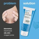 Australian Bodycare Salicylic Acid Face Wash 100 ml