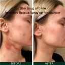 Sorted Skin Intensive Rescue Spray 50 ml