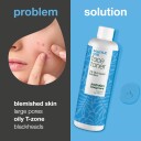 Australian Bodycare Salicylic Acid Face Toner 2% Bha Exfoliant 150 ml