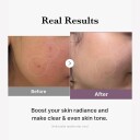 Medicube Age R Glutathione Glow Serum 30g
