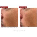 The Contour Pro