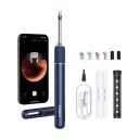 Bebird Note 5 Ørerens Med Kamera Hvit - Smart Voksfjerner