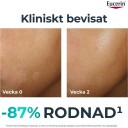 Eucerin DermoPure Hydra Repair 40 ml - Intensiv ansiktskrem for akneutsatt hud