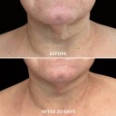 Glo Skin Beauty Bio-Renew EGF Neck Cream