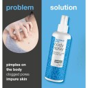Salicylic Acid Body Spray 250 ml