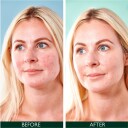 Sorted Skin 5 in 1 Anti-Redness Day Cream SPF50 30 ml