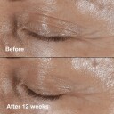 Clinique Smart Clinicial Repair Wrinkle Correcting Eye Cream 15ml