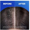 Head & Shoulders Citrus Fresh Anti Dandruff Shampoo for Greasy Hair 500ml