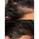 Sweed Hair Serum 6 ml for Hårvekst og Styrking