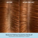 Briogeo Scalp Revival™ Dandruff Relief Conditioner 248 ml
