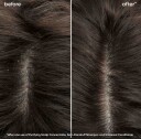 Biolage Anti-Dandruff Shampoo 250ml