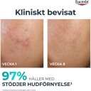 Eucerin DermoPure Peeling 10 Nattkrem med 10% Salisylsyre 40 ml