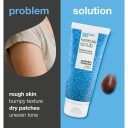 Salicylic Acid Keratosis Scrub 200 ml