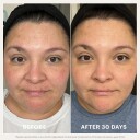 Glo Skin Beauty Renew Serum
