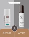 Noon Aesthetics AcNo Solution 50ml