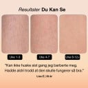 Lysterapi.no SilkSkin IPL Hårfjerner