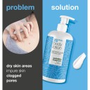 Salicylic Acid Body Lotion 500 ml