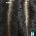 L'Oréal Professionnel Scalp Advanced Anti-Dandruff Sjampo 300 ml for Flass