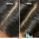 L'Oréal Professionnel Scalp Advanced Anti-Oiliness Sjampo 300 ml for Fett Hår
