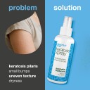 Salicylic Acid Keratosis Spray 100 ml