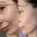 Anua Niacinamide 10% + TXA 4% Dark Spot Removing Serum 30 ml