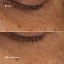 Clinique All About Eyes Brightening Serum Concentrate 10ml